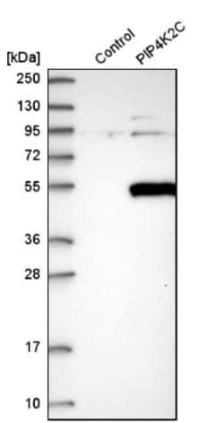 PIP5K2 gamma Antibody, Novus Biologicals 0.1mL; Unlabeled:Antibodies, Polyclonal